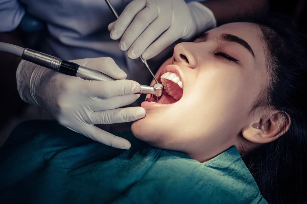 Root canal